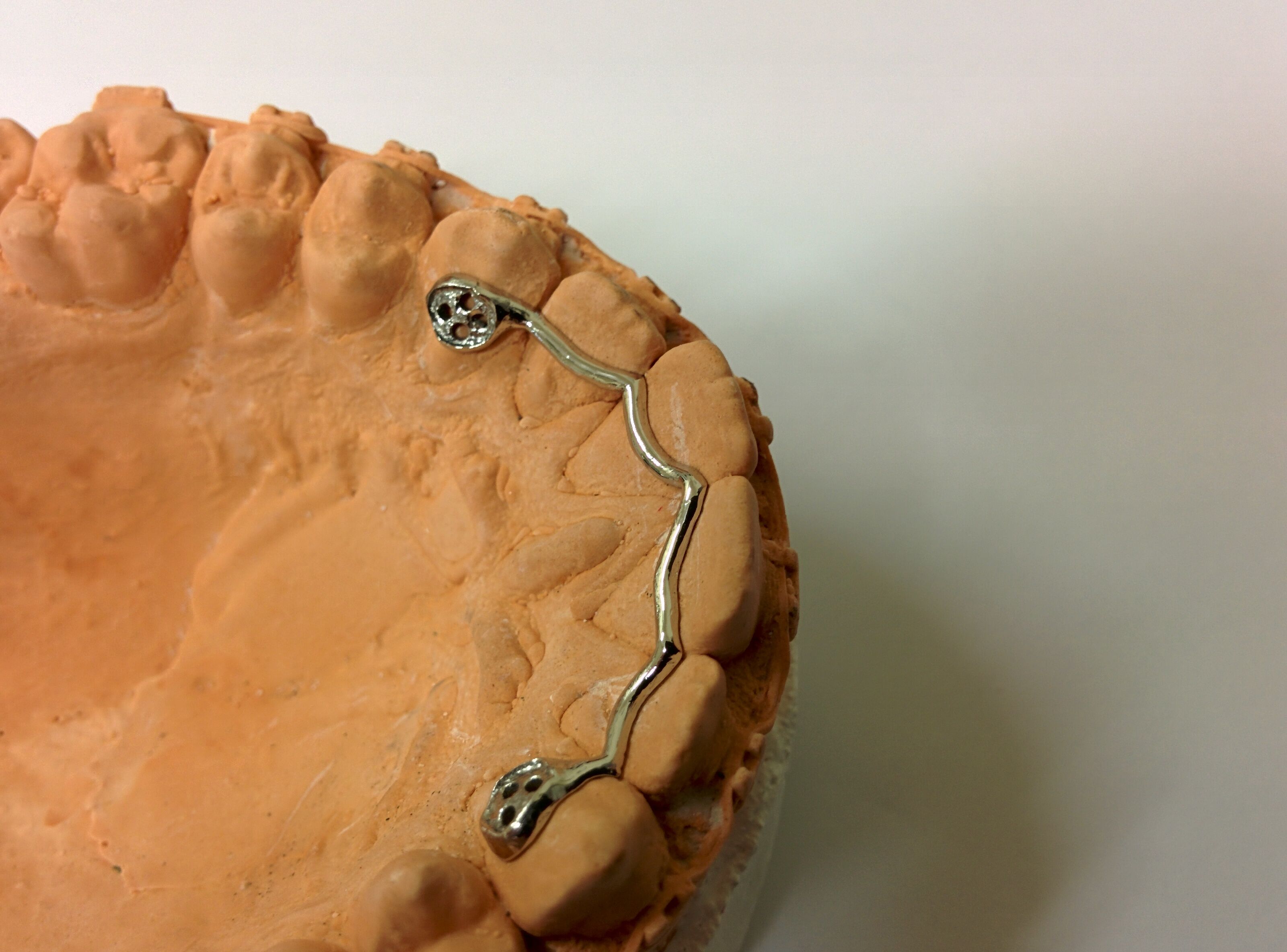 Orthodontics Dentacast